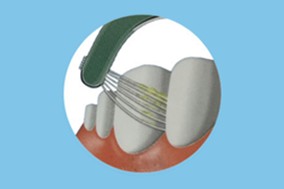 Tehnologija Buletedan